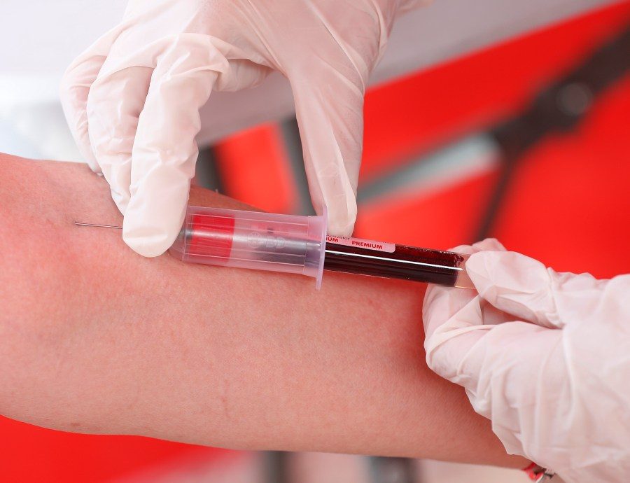 Krevní test může předpovědět nástup příznaků ALS