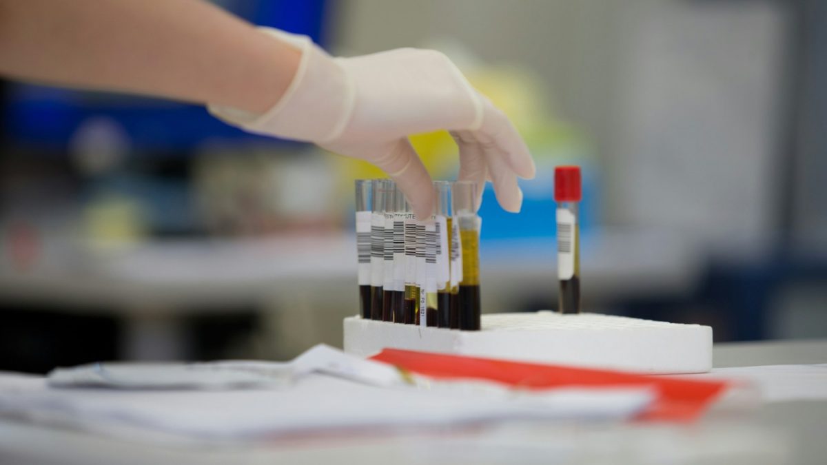 Možnosti bezplatného testování HIV: Soupravy zasílané poštou a dostupné testovací služby