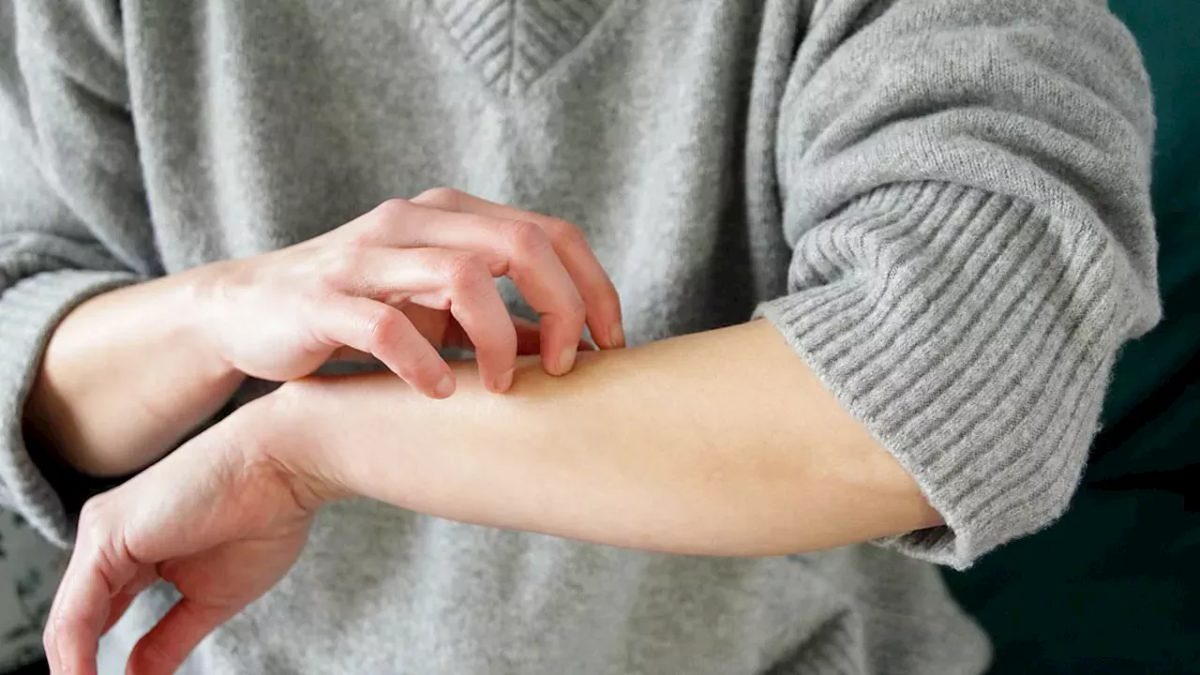 Krónikus vesebetegség: Csendes fenyegetés - Szakértői figyelmeztetés