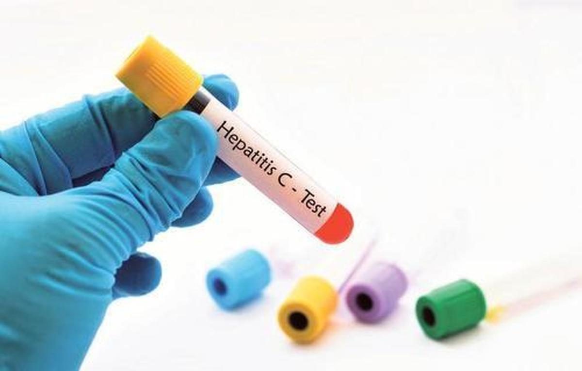 Hepatitis C: Alapvető információk és laboratóriumi vizsgálati útmutató