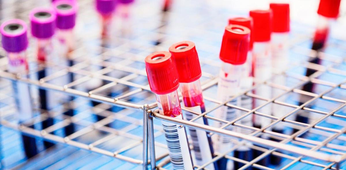 Nové krevní testy na Alzheimerovu chorobu: Měli byste se nechat otestovat?